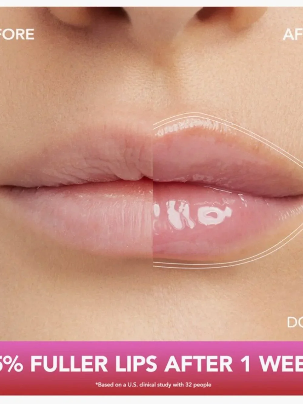 Buxom full plumping